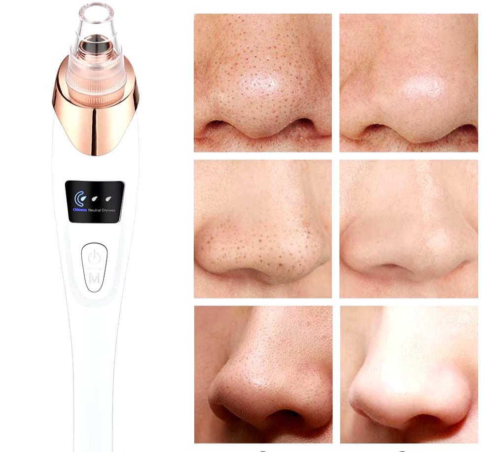 Nettoyeurs de pores / anti points noires